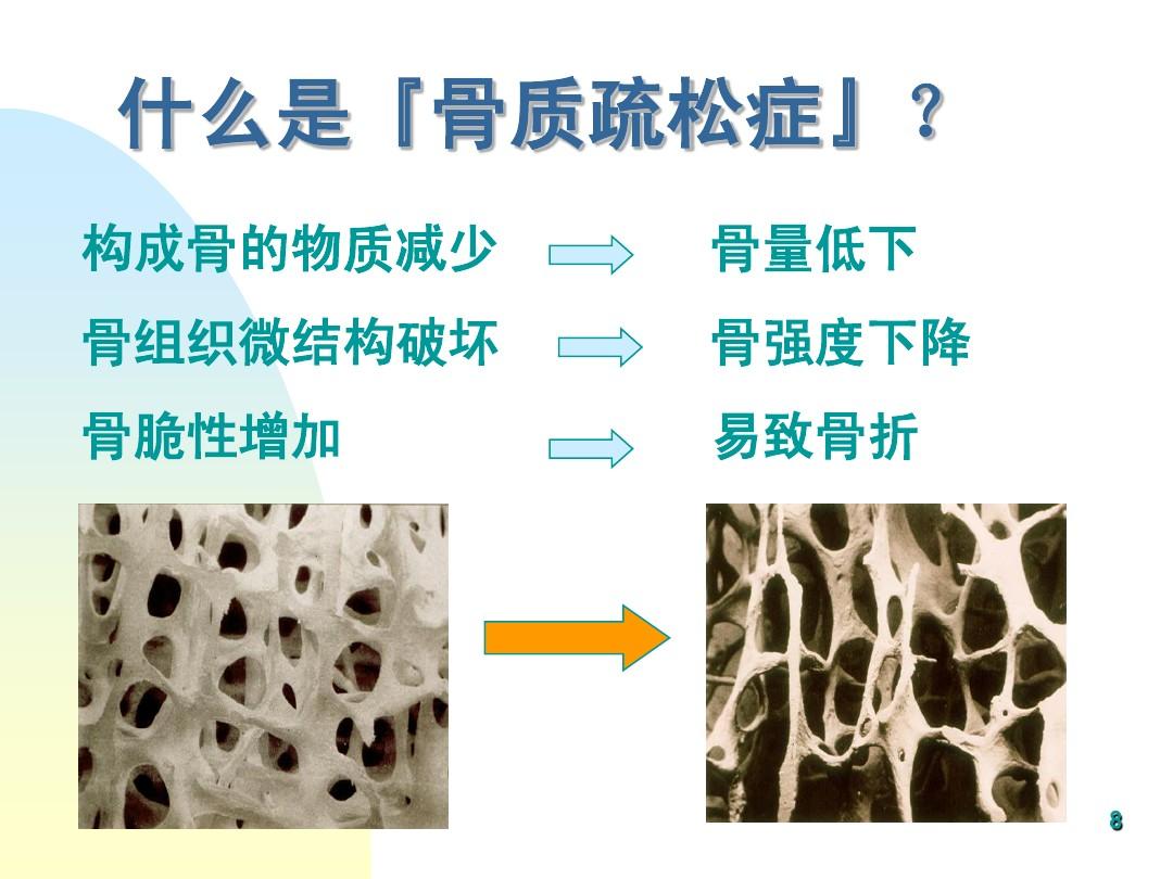 骨質疏松，可不能一(yī)“鈣”而論